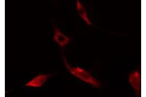 ABIN6275521 staining NIH-3T3 cells by IF/ICC. (Septin 14 anticorps  (C-Term))