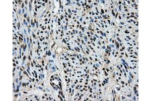 Immunohistochemical staining of paraffin-embedded Kidney tissue using anti-BRAFmouse monoclonal antibody. (BRAF anticorps)