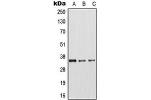 Western blot analysis of Arginase 1 expression in MCF7 (A), mouse liver (B), rat kidney (C) whole cell lysates. (Liver Arginase anticorps  (Center))