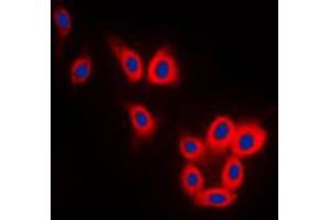 Immunofluorescent analysis of TAU staining in SKNSH cells. (tau anticorps  (C-Term))