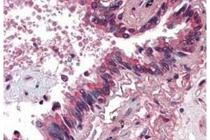 Formalin-Fixed, Paraffin-Embedded Human Lung stained with BMP4 antibody at 5 µg/ml after heat-induced antigen retrieval. (BMP4 anticorps)