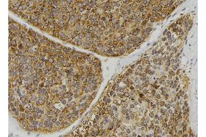 ABIN6269391 at 1/100 staining Human pancreas tissue by IHC-P.