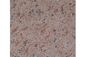 Used in DAB staining on fromalin fixed paraffin- embedded Kidney tissue (ICK anticorps  (AA 1-284))