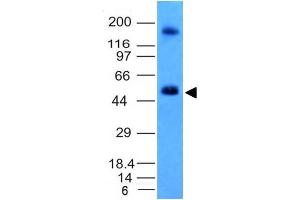 Western Blot Analysis of HCT116 cell lysate CAIX Mouse Monoclonal Antibody (CA9/781). (CA9 anticorps)