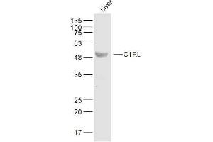 Mouse liver lysates probed with C1RL Polyclonal Antibody, Unconjugated  at 1:500 dilution and 4˚C overnight incubation. (C1RL anticorps  (AA 101-200))