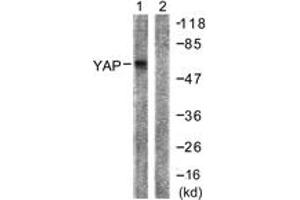 Western blot analysis of extracts from HepG2 cells, treated with Wortmannin 40nM 24h, using YAP (Ab-127) Antibody. (YAP1 anticorps  (AA 93-142))