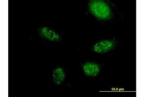 Immunofluorescence of purified MaxPab antibody to ZNF501 on HeLa cell. (ZNF501 anticorps  (AA 1-262))