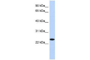 NKAIN4 antibody used at 1 ug/ml to detect target protein. (NKAIN4 anticorps  (N-Term))