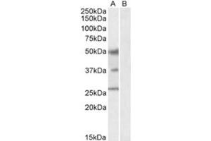 Image no. 1 for anti-Forkhead Box A1 (FOXA1) (C-Term) antibody (ABIN374334) (FOXA1 anticorps  (C-Term))