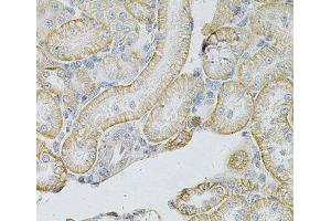 Immunohistochemistry of paraffin-embedded Rat kidney using MSLN Polyclonal Antibody at dilution of 1:100 (40x lens). (Mesothelin anticorps)