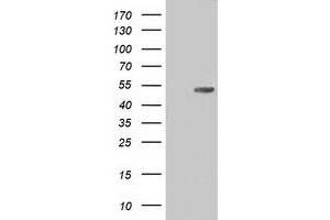 HEK293T cells were transfected with the pCMV6-ENTRY control (Left lane) or pCMV6-ENTRY CD5 (Right lane) cDNA for 48 hrs and lysed. (CD5 anticorps)