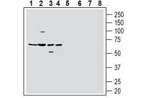 Western blot analysis of mouse brain membranes (lanes 1 and 5), rat brain membranes (lanes 2 and 6), rat lung membranes (lanes 3 and 7) and mouse lung membranes (lanes 4 and 8): - 1-4.