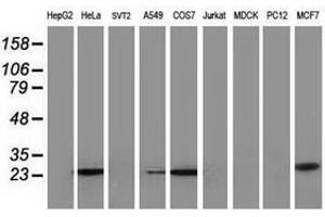 Image no. 4 for anti-Adenylate Kinase 4 (AK4) antibody (ABIN1496530) (AK4 anticorps)