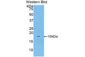 Western Blotting (WB) image for anti-Lecithin-Cholesterol Acyltransferase (LCAT) (AA 290-433) antibody (Biotin) (ABIN1176764)