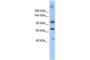 WB Suggested Anti-TUT1 Antibody Titration: 0. (TUT1 anticorps  (N-Term))