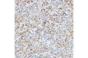Immunohistochemistry of paraffin-embedded rat ovary using  Rabbit pAb (ABIN7265359) at dilution of 1:50 (40x lens).