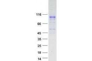 Validation with Western Blot