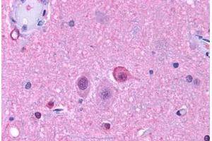Anti-NPY5R antibody  ABIN1049127 IHC staining of human brain, neurons and glia. (NPY5R anticorps  (Cytoplasmic Domain))