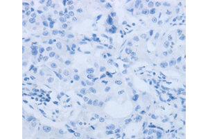 Immunohistochemistry (IHC) image for anti-Matrix Metallopeptidase 25 (MMP25) antibody (ABIN1873725) (MMP25 anticorps)