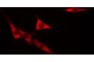 ABIN6268773 staining hacat cells by IF/ICC.