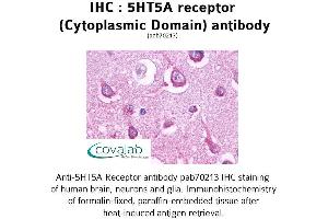 Image no. 1 for anti-Serotonin Receptor 5A (HTR5A) (3rd Cytoplasmic Domain) antibody (ABIN1731379)