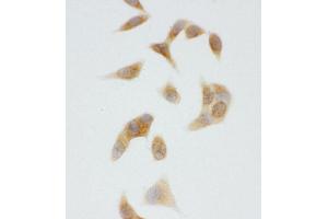 Anti-CYP2U1 antibody, ICC ICC: HELA Cell