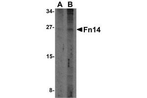 Western blot analysis of Fn14 in HepG2 cells with AP30344PU-N Fn14 antibody at (A) 2 and (B) 4 μg/ml. (TNFRSF12A anticorps)