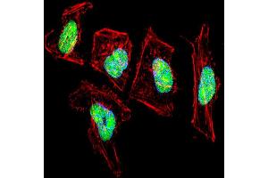 Fluorescent confocal image of Hela cell stained with NFIC Antibody . (NFIC anticorps  (AA 180-208))