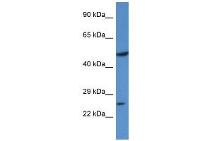 Western Blotting (WB) image for anti-Kruppel-Like Factor 17 (KLF17) (N-Term) antibody (ABIN2778556) (KLF17 anticorps  (N-Term))