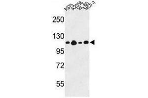 Western blot analysis of COL17A1 Antibody (Center) in A375, A2058, HL-60, MCF-7 cell line lysates (35µg/lane). (COL17A1 anticorps  (Chain alpha 1, Middle Region))