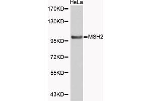 Western blot analysis of extracts of HeLa cells, using MSH2 antibody (ABIN5969993). (MSH2 anticorps)