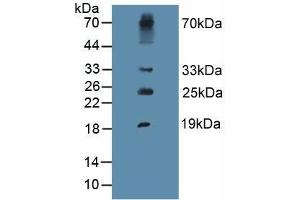 Figure. (PIIINP anticorps  (AA 24-153))