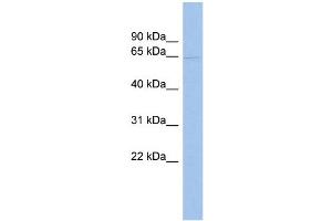 WB Suggested Anti-TRIM23 Antibody Titration:  0. (TRIM23 anticorps  (Middle Region))