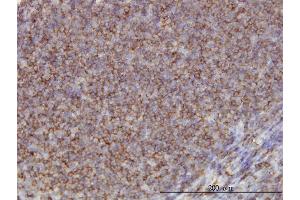 Immunoperoxidase of monoclonal antibody to ADD1 on formalin-fixed paraffin-embedded human tonsil.