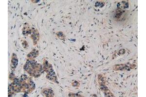 IHC-P analysis of Human Breast Tissue, with DAB staining. (Ataxin 1 anticorps  (AA 569-807))