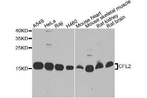 Western blot analysis of extracts of various cell lines, using CFL2 antibody. (Cofilin 2 anticorps  (AA 1-166))