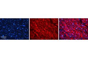 Rabbit Anti-STUB1 Antibody   Formalin Fixed Paraffin Embedded Tissue: Human heart Tissue Observed Staining: Cytoplasmic Primary Antibody Concentration: N/A Other Working Concentrations: 1:600 Secondary Antibody: Donkey anti-Rabbit-Cy3 Secondary Antibody Concentration: 1:200 Magnification: 20X Exposure Time: 0.