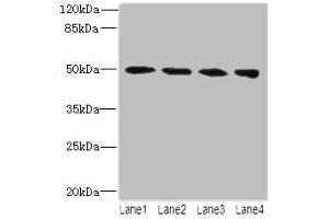 Western blot All lanes: TUBB2A antibody at 14 μg/mL Lane 1: MCF-7 whole cell lysate Lane 2: Hela whole cell lysate Lane 3: HepG2 whole cell lysate Lane 4: MDA-MB-231 whole cell lysate Secondary Goat polyclonal to rabbit IgG at 1/10000 dilution Predicted band size: 50 kDa Observed band size: 50 kDa (TUBB2A anticorps  (AA 1-445))