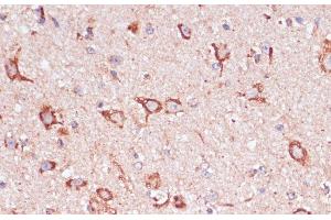 Immunohistochemistry of paraffin-embedded Mouse spinal cord using ENTPD6 Polyclonal Antibody at dilution of 1:100 (40x lens). (ENTPD6 anticorps)
