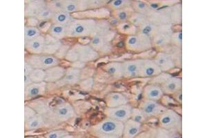 IHC-P analysis of Human Tissue, with DAB staining. (SLC1A5 anticorps  (AA 327-541))