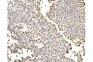 IHC analysis of SSB using anti-SSB antibody (ABIN7602125). (SSB anticorps  (AA 6-283))