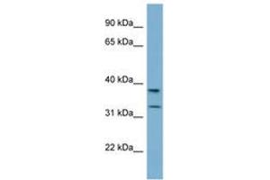 Image no. 1 for anti-Ral GEF with PH Domain and SH3 Binding Motif 2 (RALGPS2) (N-Term) antibody (ABIN6742100)