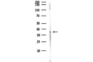 Western blot analysis of lysates from HepG2 cells(heat-shock,45 min treatment), using LRRC67 Antibody at 1/1000 dilution.