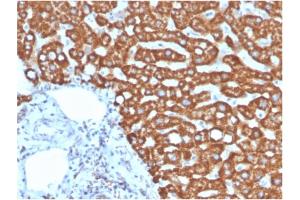 Formalin-fixed, paraffin-embedded human liver in colon stained with Heat Shock Protein 60 Mouse Monoclonal Antibody (HSPD1/875). (HSPD1 anticorps)