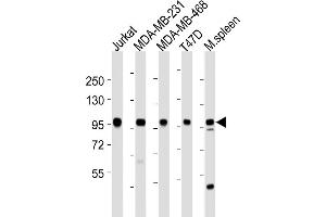 All lanes : Anti-EZH2 Antibody at 1:2000 dilution Lane 1: Jurkat whole cell lysates Lane 2: MDA-MB-231 whole cell lysates Lane 3: MDA-MB-468 whole cell lysates Lane 4: T47D whole cell lysates Lane 5: mouse spleen lysates Lysates/proteins at 20 μg per lane.