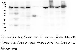 Western blot analysis of CRM1 using anti-CRM1 antibody . (XPO1 anticorps  (AA 966-1071))