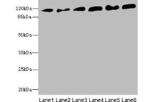 Western blot All lanes: PCDH1 antibody at 2. (Protocadherin 1 anticorps  (AA 60-220))