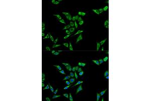 Immunofluorescence analysis of A549 cells using ACAT1 antibody (ABIN5973073). (ACAT1 anticorps)