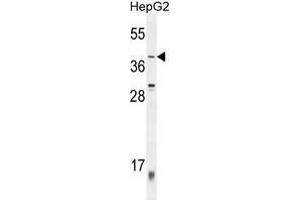 ZNF763 Antibody (C-term) western blot analysis in HepG2 cell line lysates (35 µg/lane). (ZNF763 anticorps  (C-Term))