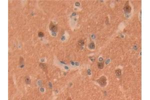 Detection of UCHL1 in Human Brain Tissue using Polyclonal Antibody to Ubiquitin Carboxyl Terminal Hydrolase L1 (UCHL1)